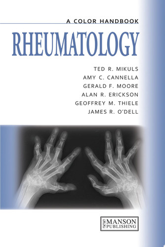 Rheumatology A Color Handbook