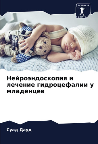 Нейроэндоскопия и лечение гидроцефалии у младенцев