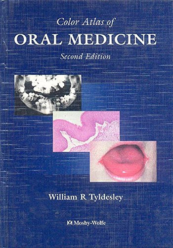 Color Atlas of Oral Medicine