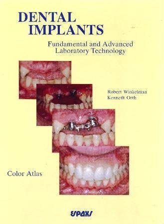 Dental Implants Fundamental and Advanced Laboratory Technology