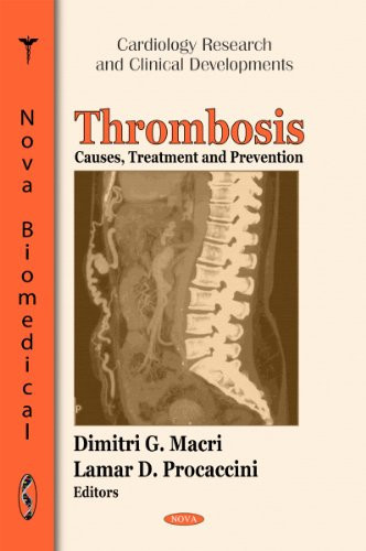 Thrombosis Causes, Treatment, and Prevention