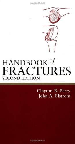 Handbook of Fractures