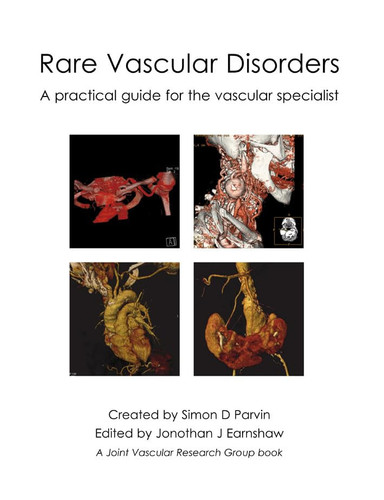 Rare Vascular Disorders: A practical guide for the vascular specialist