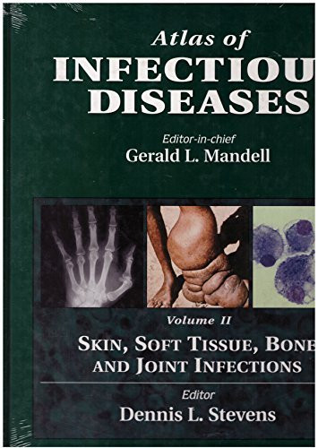 Skin, soft tissue, bone, and joint infections