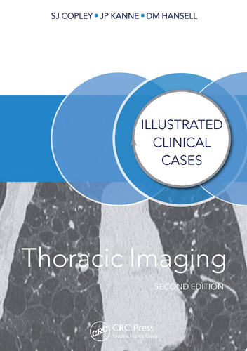 Thoracic Imaging Illustrated Clinical Cases, Second Edition