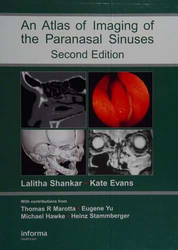 Atlas of Imaging of the Paranasal Sinuses, Second Edition