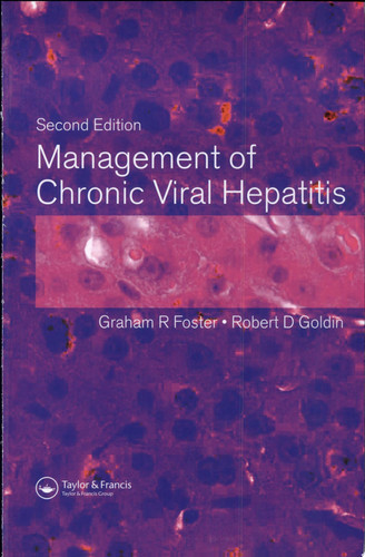 Management of Chronic Viral Hepatitis, Second Edition