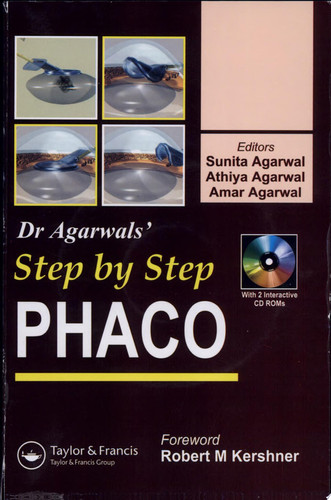 Step by Step Phacoemulsification