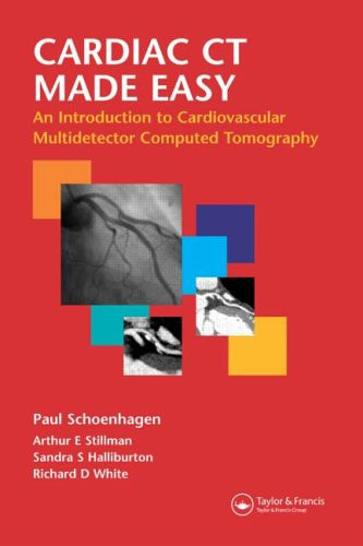 Cardiac CT Made Easy An Introduction to Cardiovascular Multidetector Computed Tomography
