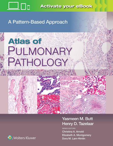 Atlas of Pulmonary Pathology A Pattern Based Approach