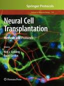Neural Cell Transplantation Methods and Protocols