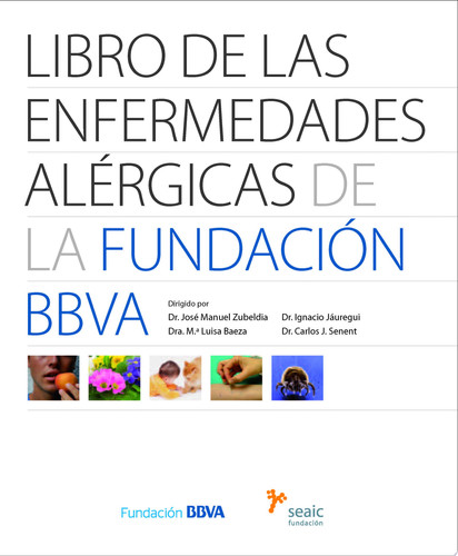 Libro de las enfermedades alérgicas de la Fundación BBVA - Ignacio Jáuregui, José Manuel Zubeldia, María Luisa Baeza, Carlos J. Senent