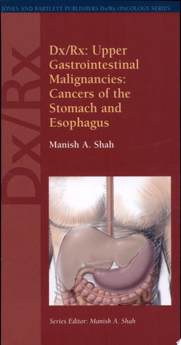Upper Gastrointestinal Malignancies Cancers of the Stomach and Esophagus
