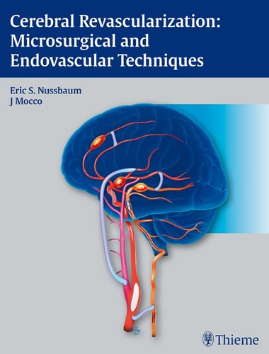 Cerebral Revascularization Microsurgical and Endovascular Techniques