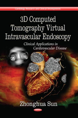 3D Computed Tomography Virtual Intravascular Endoscopy Clinical Applications in Cardiovascular Disease
