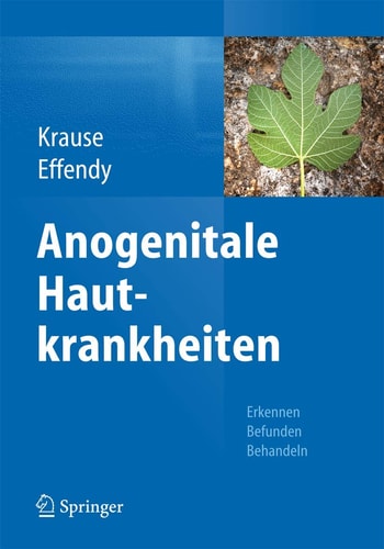 Anogenitale Hautkrankheiten: Erkennen, Befunden, Behandeln