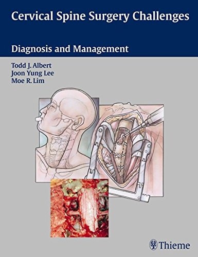 Cervical spine surgery challenges : diagnosis and management