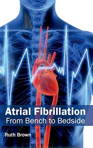 Atrial Fibrillation: from Bench to Bedside