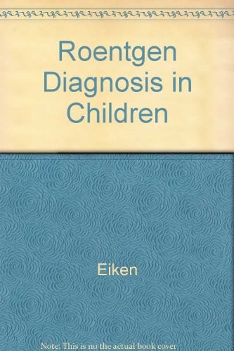 Cover of Roentgen Diagnosis in Children