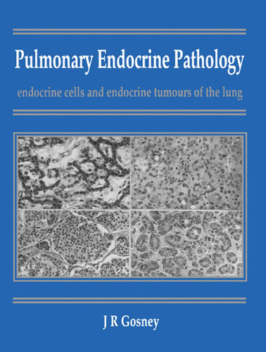 Pulmonary Endocrine Pathology: Endocrine Cells and Endocrine Tumours of the Lung