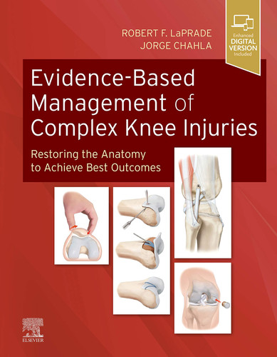 Evidence-Based Management of Complex Knee Injuries Restoring the Anatomy to Achieve Best Outcomes