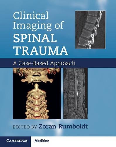 Clinical Imaging of Spinal Trauma A Case-Based Approach