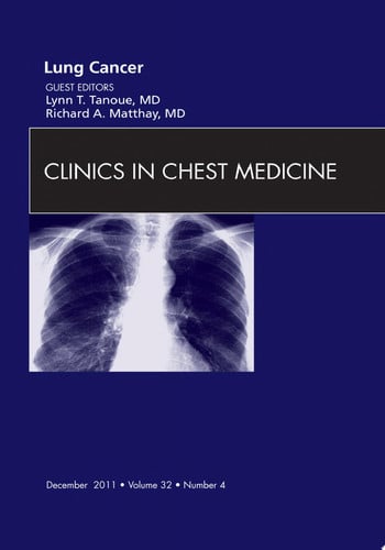Lung Cancer, An Issue of Clinics in Chest Medicine