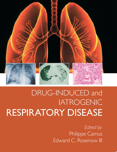 Drug-induced and Iatrogenic Respiratory Disease