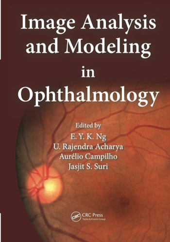Image Analysis and Modeling in Ophthalmology